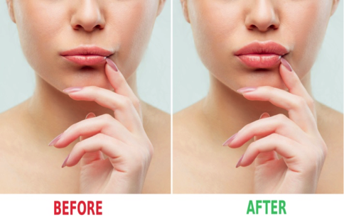 Health Benefits Of Having A Cosmetic Enhancement
